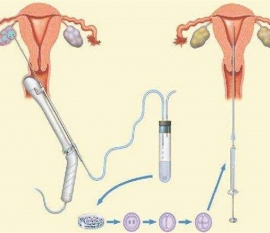 35岁女性备孕请做好以下检查，“健康厦门代生宝宝”跑不远